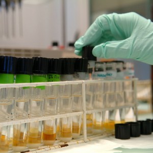 A laboratory technician prepares urine samples for tests on doping at the Swiss Laboratory for Doping Analysis in Lausanne, January 17, 2006. A team of the laboratory, which forms part of the Institute of Forensic Medicine at the University of Lausanne and is one of thirty-three WADA-accredited laboratories for in- and out-of-competition testing, will be present to perfom blood transfusion tests at the upcoming XXth Olympic Winter Games in Turin. REUTERS/ARC-Jean-Bernard Sieber
